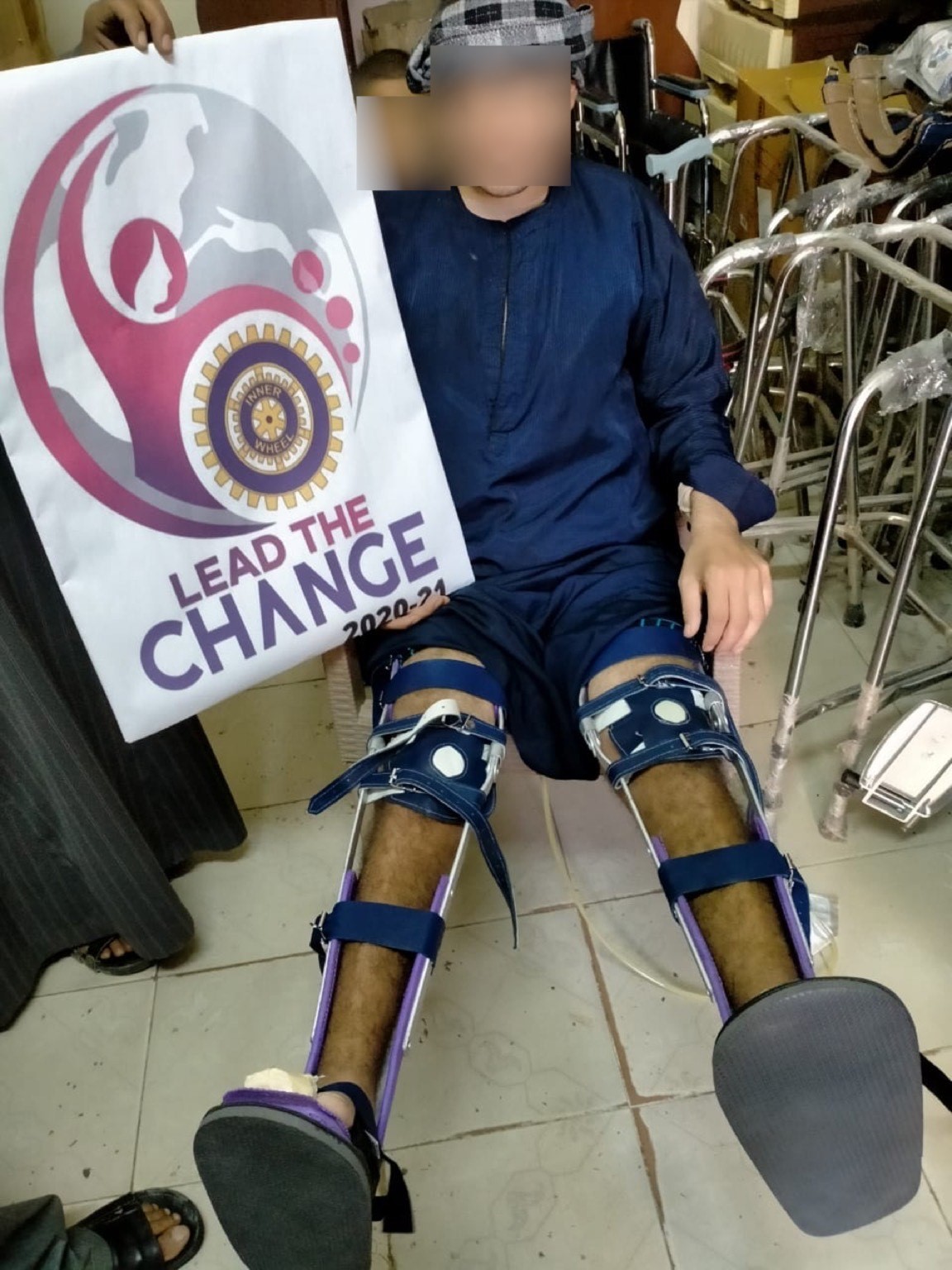 The motor prosthetic device given by IWC of El Minya