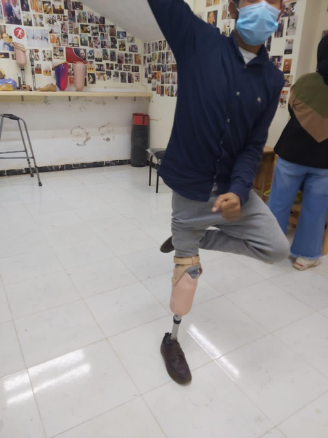 The young man with an artificial limb