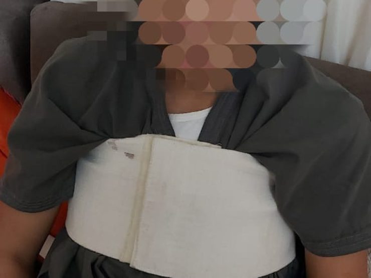 A fifteen year old youth after an open heart surgery
