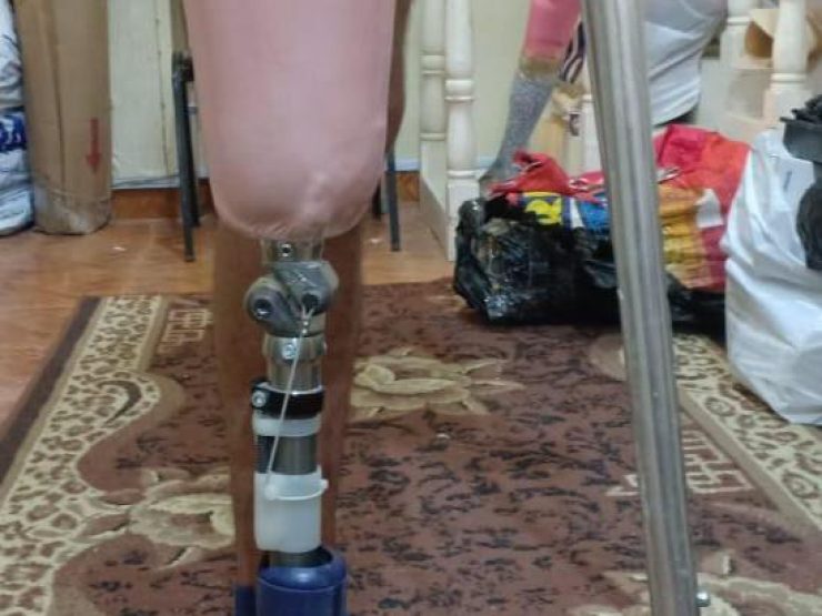 1-The donated Prosthetic limb